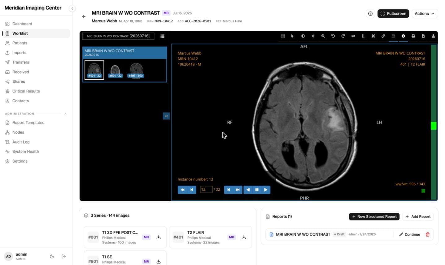 The browser viewer: an axial MRI brain with classic orange DICOM overlays